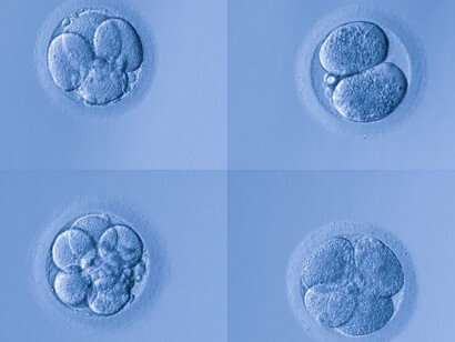 Division. Au cours du XVIIe siècle et jusqu’au milieu du XVIIIe siècle, la controverse fait rage sur le problème de la génération comme on la nomme alors, savoir comment se forment puis se développent l’œuf et l’embryon