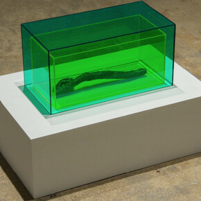 A Detached Hand. Courtesy of Magenta Plains