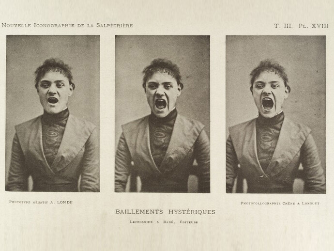 Three photos in a series showing Early animated picture by John Arthur Roebuck Rudge depicting the face of William Friese-G a hysterical woman yawning
