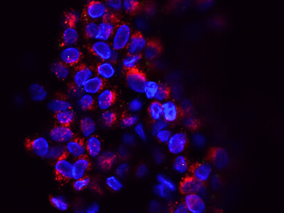 Dans le cytoplasme de ces cellules, les ribosomes traduisent le message de l’ARN messager en chaînes de protéines indispensables à la vie