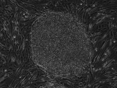 Mesenchymal stem cells seen under the microscope—tiny agents of healing in the fight against chronic joint pain