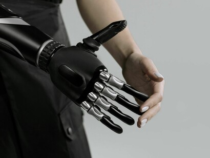 La neurotecnología ofrece autonomía a pacientes con parálisis mediante el control de extremidades robóticas