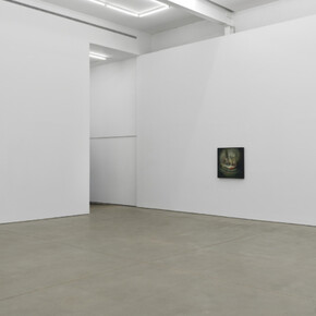 Kate Hargrave, Milk teeth, exhibiton view. Courtesy of Karma Gallery