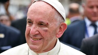 El papa, con el rostro magullado tras golpearse contra el cristal del papamóvil mientras recorría el barrio de San Francisco, en Cartagena