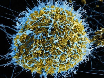 Virus dell'Ebola