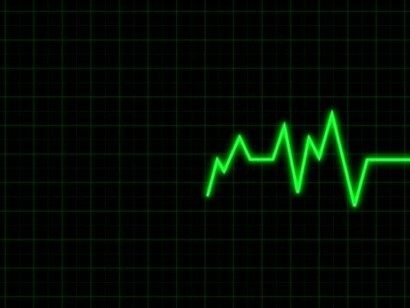 L’elettrocardiogramma (ECG) è molto importante, soprattutto subito dopo l’evento sincopale, sia per evidenziare alterazioni che possono essere diagnostiche di per sé, sia perché alcune alterazioni possono suggerire la necessità di accertamenti più approfonditi
