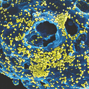 Outbreak: Epidemics in a Connected World. Courtesy of Smithsonian's National Museum of Natural History
