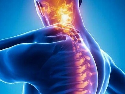 L'osteoporosi colpisce le vertebre