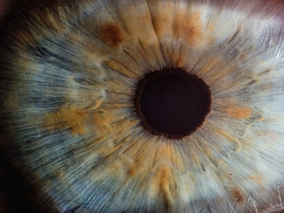 Ojo