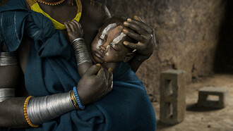 Steve McCurry, Etiópia, mãe protegendo sua menina