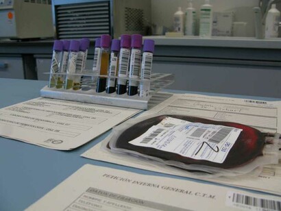 Bolsa de sangre extraída del cordón umbilical
