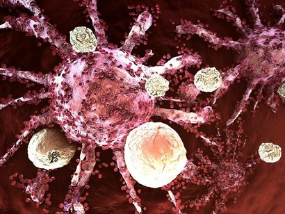 T cells, which are one of the most important parts of the immune system, attack a cancer cell