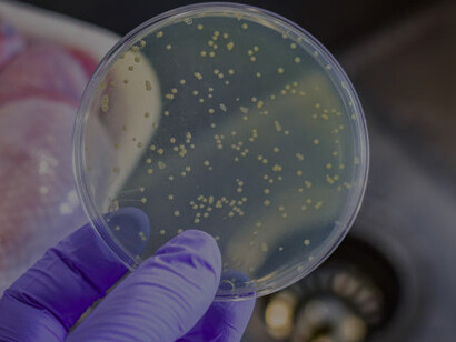 A hand holding a petri dish with Salmonella and E. coli colonies