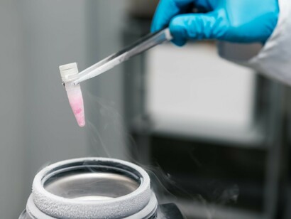 Un técnico guarda una muestra extraída del cordón umbilical de un recién nacido