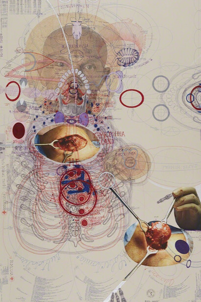 Luboš Plný, Lobectomia Subtotalis, 2017. Courtesy of Cavin-Morris Gallery