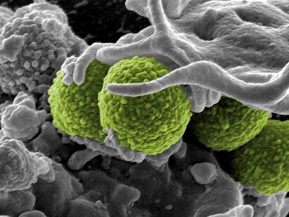 Superbacterias