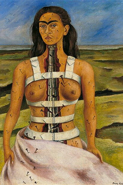 Frida Kahlo. The broken column
