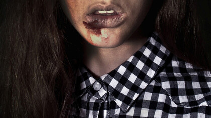 Mujer víctima de violencia machista