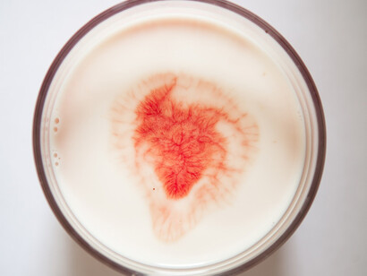 L’albero del latte. Courtesy of Fondazione Dino Zoli