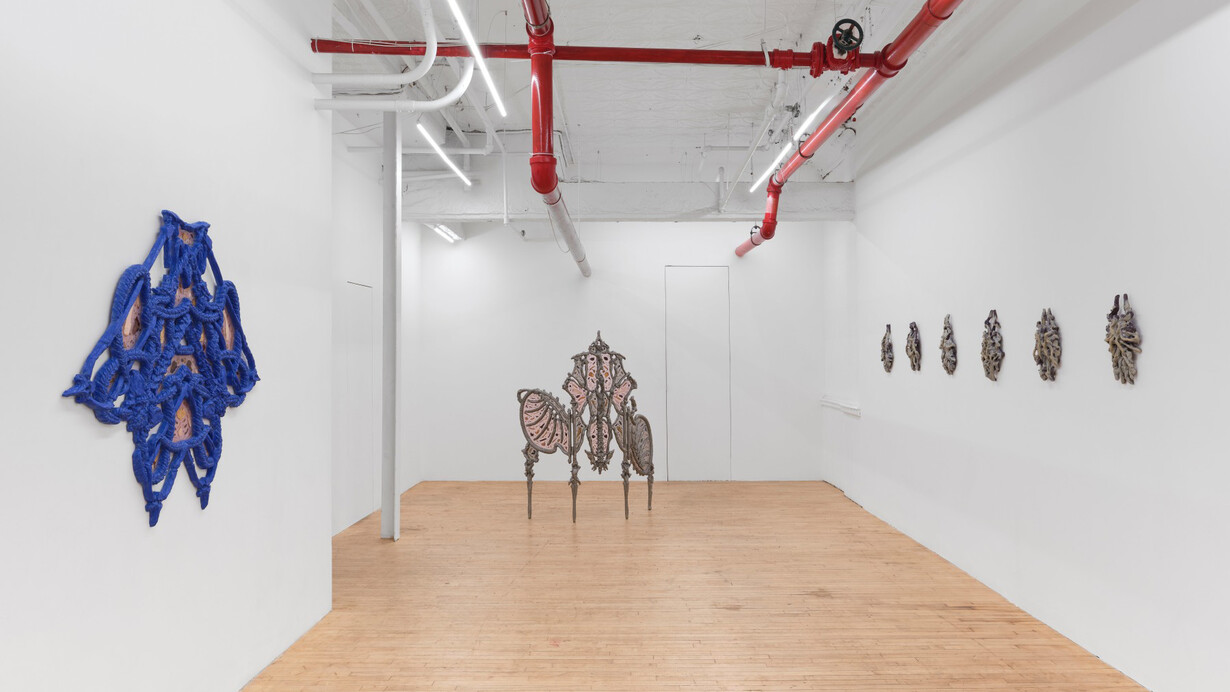 Wen Liu, Antidote, exhibition view. Courtesy of Gaa Gallery
