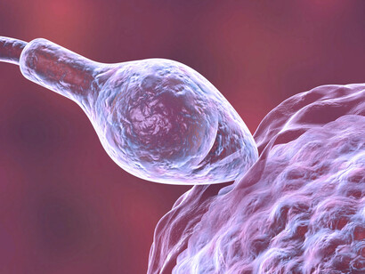 Espermatozoide fertilizando un óvulo