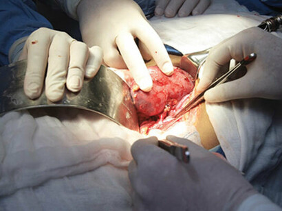 Casi 5.000 órganos se trasplantaron en España durante 2016