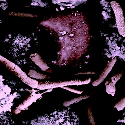 Fotografía con microscopio electrónico del «Bacillus anthracis» en el bazo de un mono