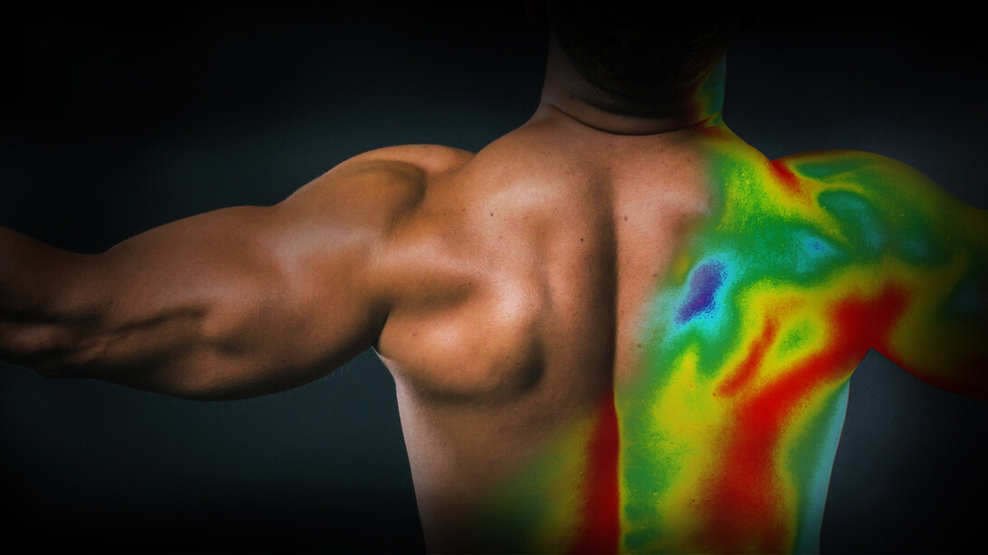 Infrared thermal image of a human body