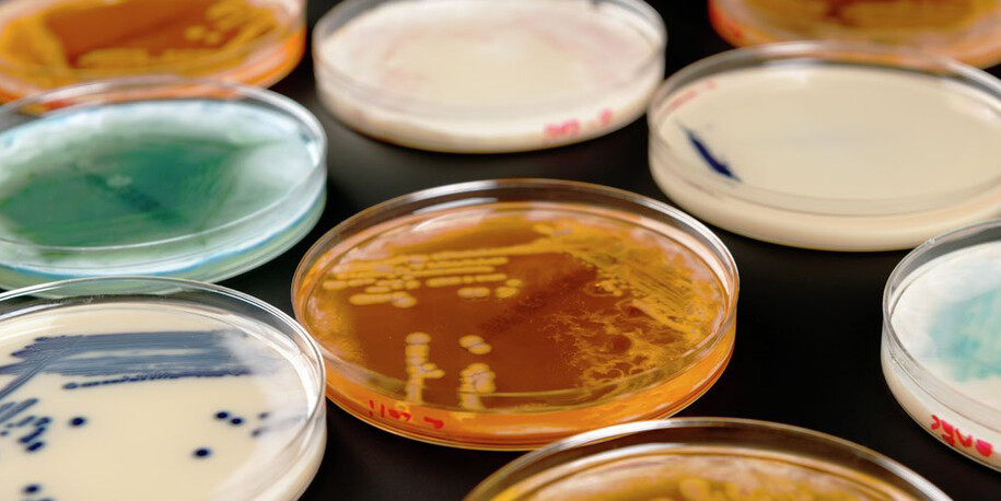 Superbugs. Courtesy of Science Museum