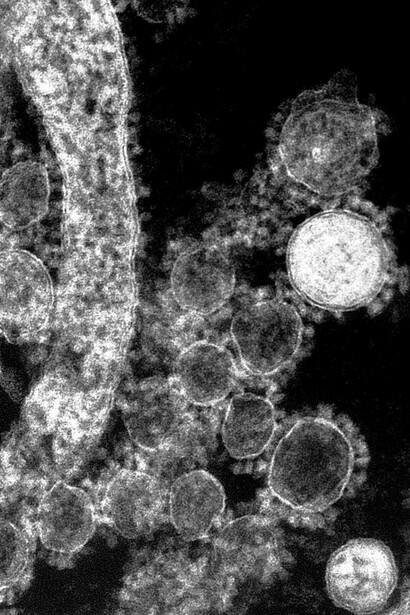 Microorganismes. Devenu ainsi le « maître des microbes », Pasteur peut supprimer leur virulence ou la redonner à volonté et, surtout, fabriquer des vaccins
