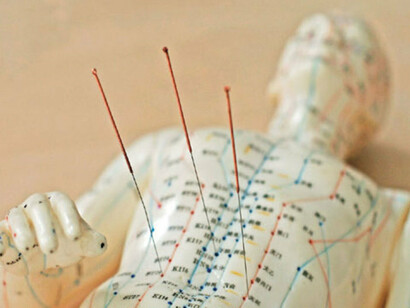 Acupuncture meridians