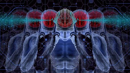 Chip nel cervello. Il primo uomo ha ricevuto un impianto da Neuralink e si sta riprendendo bene. I risultati iniziali mostrano un promettente rilevamento di picchi neuronali