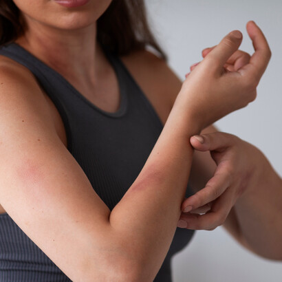Doenças geradas pro produtos tóxicos. A exposição constante a produtos químicos como corantes, solventes e formaldeído pode levar ao desenvolvimento de doenças ocupacionais graves, incluindo doenças respiratórias, dermatites e cancro