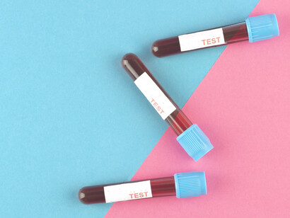 La falta de estudios específicos sobre síntomas femeninos —como en el caso de los infartos— hace que los profesionales de la salud no reconozcan fácilmente sus manifestaciones atípicas