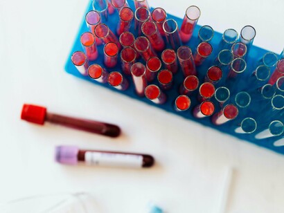 Tubos de ensaio com amostras de sangue. Uma vez doado, o sangue é processado para separar seus componentes, e cada um deles é usado em pacientes com diferentes necessidades. Também se pode doar um componente específico por um procedimento chamado aférese, onde se extrai o componente desejado e se retorna o restante do sangue ao doador