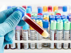 Formulare una diagnosi corretta è molto importante per il paziente ma disporre di più informazioni non è sempre utile