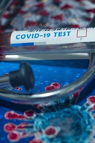 The SARS-CoV-2 has met the two basic definitions of a pandemic