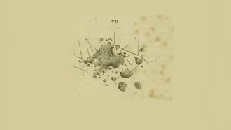 Riproduzione dell'aspetto microscopico del materiale ateromatoso nelle tavole del libro di Jiulius Vogel "Icones Histologiae Pathologicae", 1843