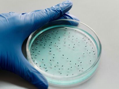 Las bacterias son organismos unicelulares muy antiguos y diversos, esenciales para muchos procesos ecológicos