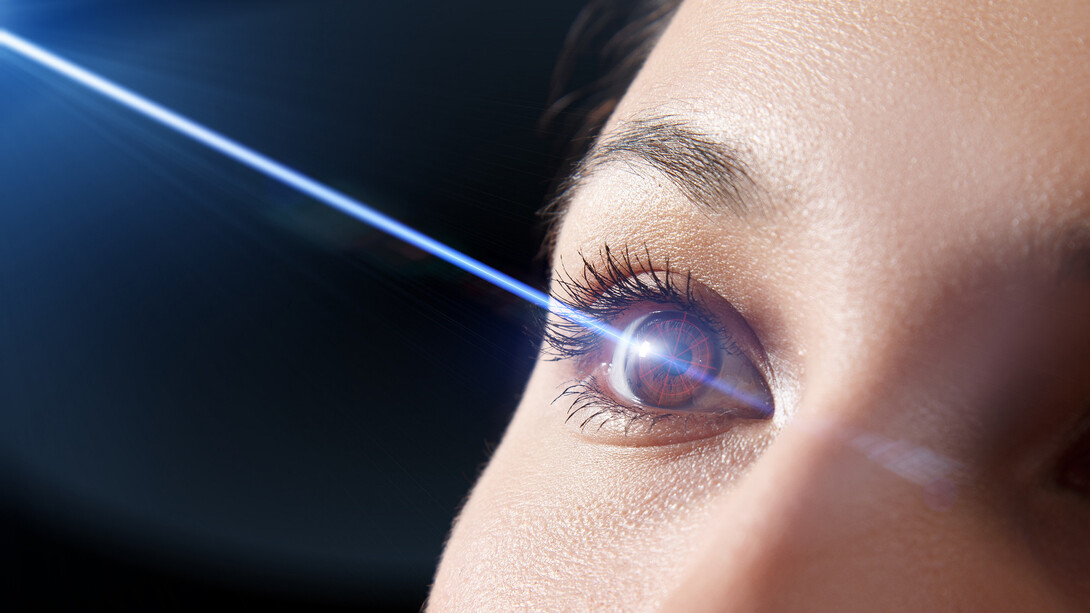 Lasik surgery