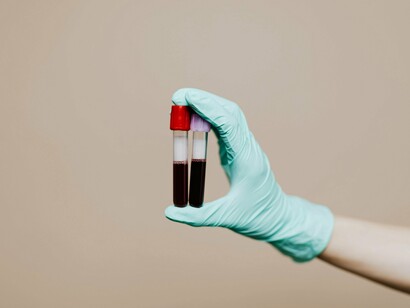 No entanto, é fundamental desconfiar de promessas milagrosas e produtos que circulam na internet e nas redes sociais prometendo resultados instantâneos. Suplementos e equipamentos sem respaldo científico ou aprovação de órgãos reguladores podem não só ser ineficazes, como também prejudicar a saúde. O biohacking responsável é aquele que se baseia em evidências, com acompanhamento profissional, e respeita os limites do corpo e as normas do esporte