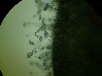 A closer look at Botrytis conidiophores