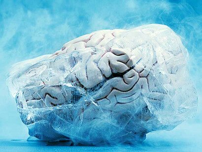 Hay dos grandes alternativas en los procesos de criogenización: congelar el cuerpo o congelar solo el cerebro