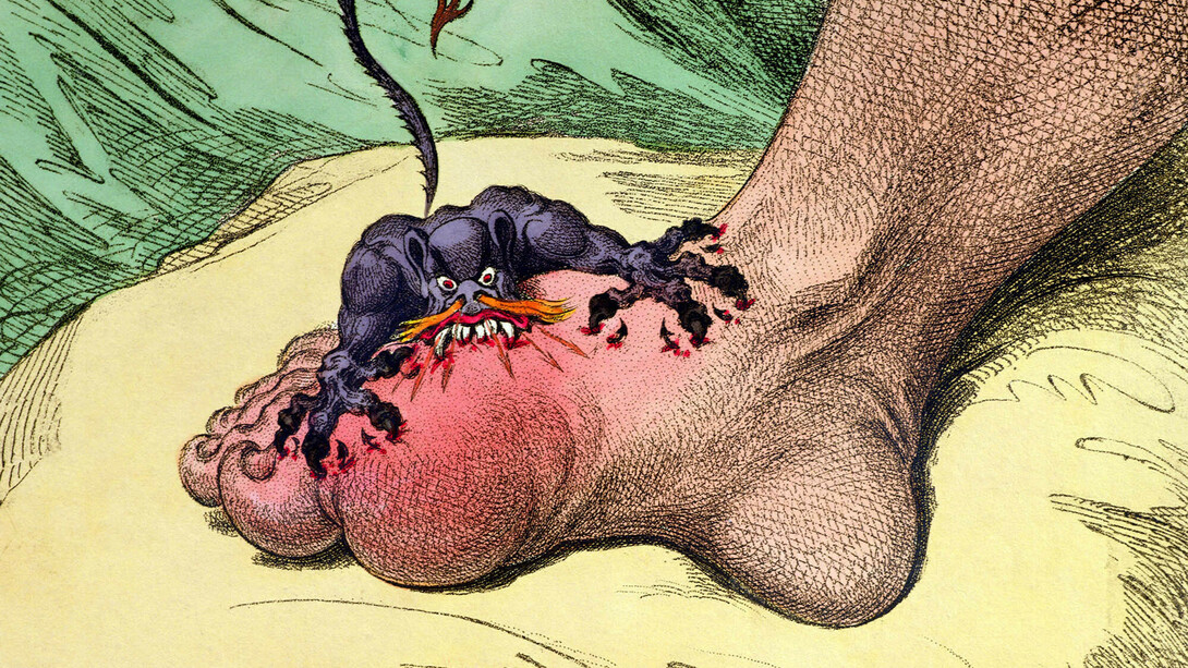 James Gillray (1757‒1815), The Gout, 1799, Hand-coloured soft ground etching, 26 x 35.5 cm © Courtesy of the Warden and Scholars of New College, Oxford / Bridgeman Images