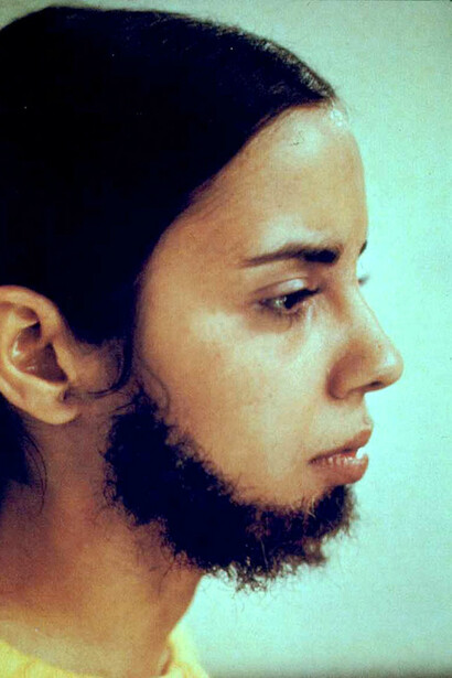 Ana Mendieta, Facial Hair Transplan