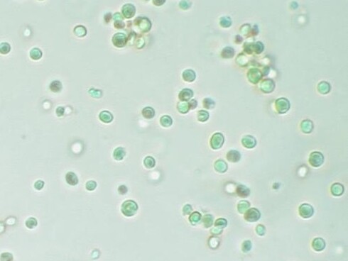 Microalgas