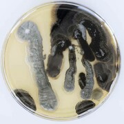 Kelvin Haizel, Unseen allies. A set of ten petri dishes with cultured microbes, 1885-2026. Courtesy of FOMU Foto Museum 