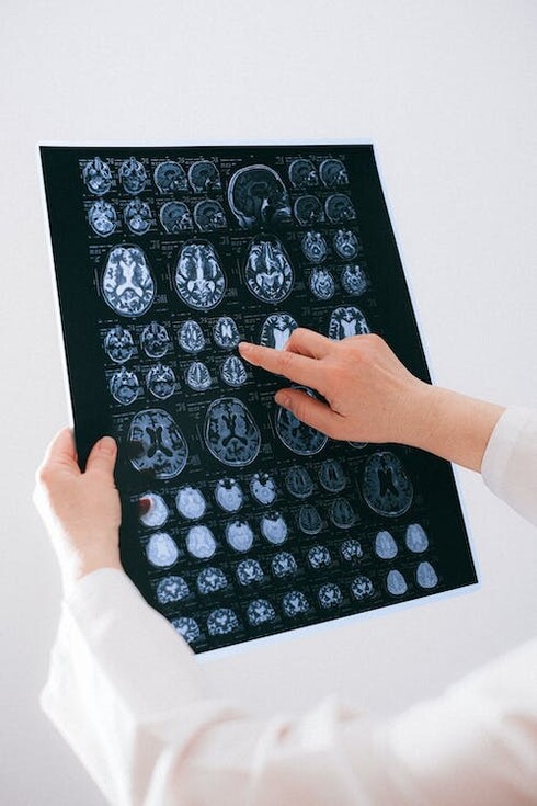 Uno dei primi pionieri della neuroplasticità fu Paul Bach-y-Rita, che nel 1967 introdusse la "sensory substitution"