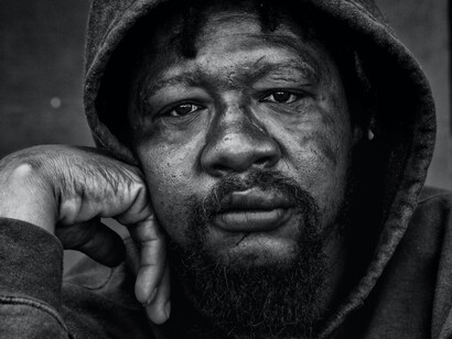 Rodney, a homeless man living on the streets of Milwaukee, Wisconsin; has since gotten treatment 
