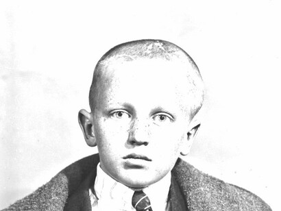 Las imágenes de los pacientes de Cushing representan un fondo de gran valor